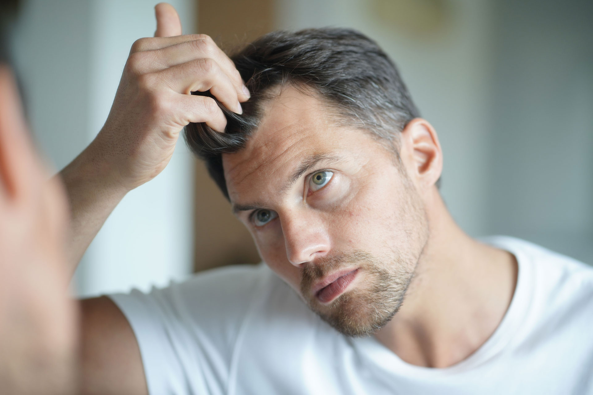 Ockenfels Haartransplantation bei männlichem Haarausfall